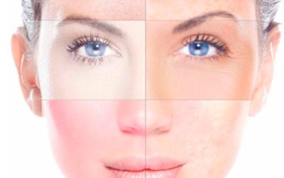 Tratamiento Facial Personalizado