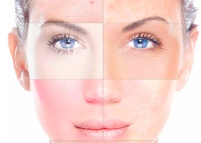 Tratamiento Facial Personalizado