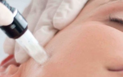 Mesopen/Microneedling