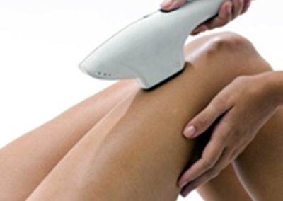 Depilación con Láser Médico Diodo