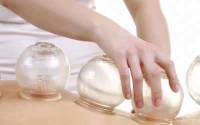Terapia Cupping