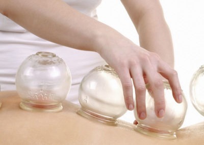Terapia Cupping