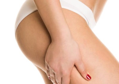 Masaje Anticelulítico