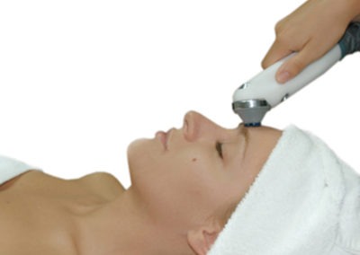 Radiofrecuencia Facial