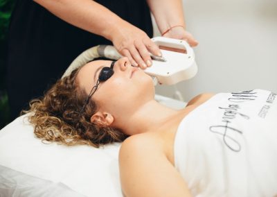 Fotorejuvenecimiento/IPL (Luz Pulsada)