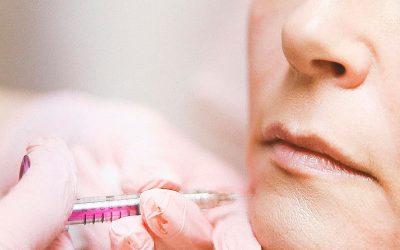 Rellenos con Ácido Hialurónico